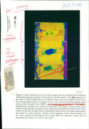 Body scanners:intervertebral disc have no blood supply - Vintage Photograph