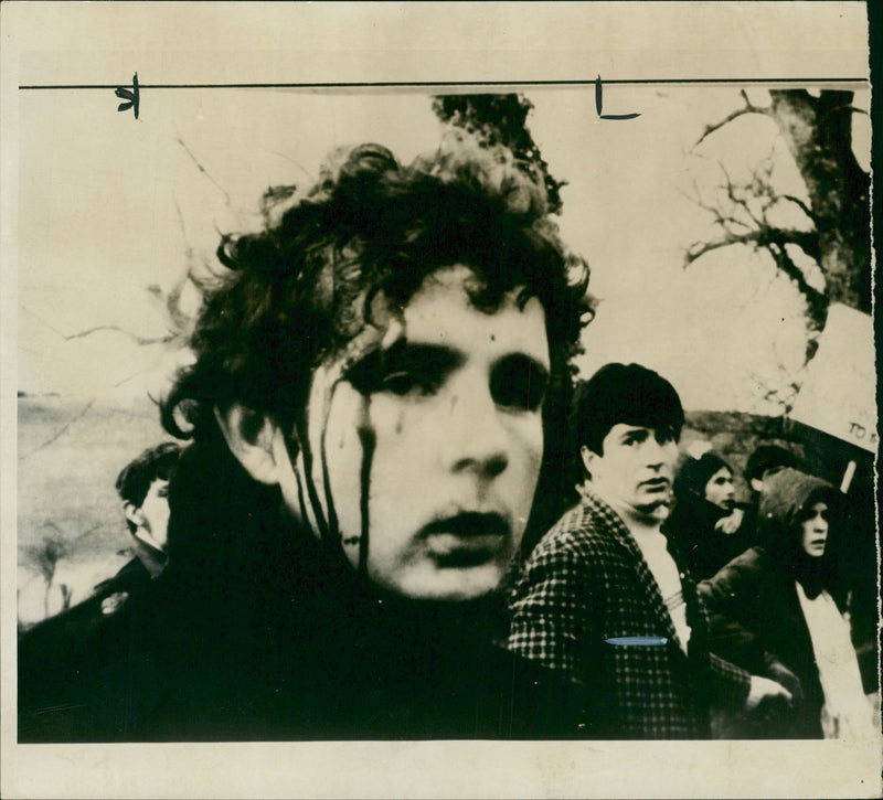 Blood streaming from a marcher's head wound. - Vintage Photograph