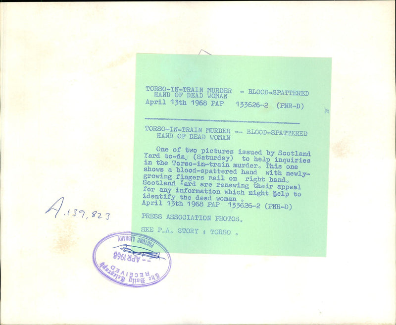 Blood spattered hand of dead woman. - Vintage Photograph