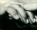 Blood spattered hand of dead woman. - Vintage Photograph