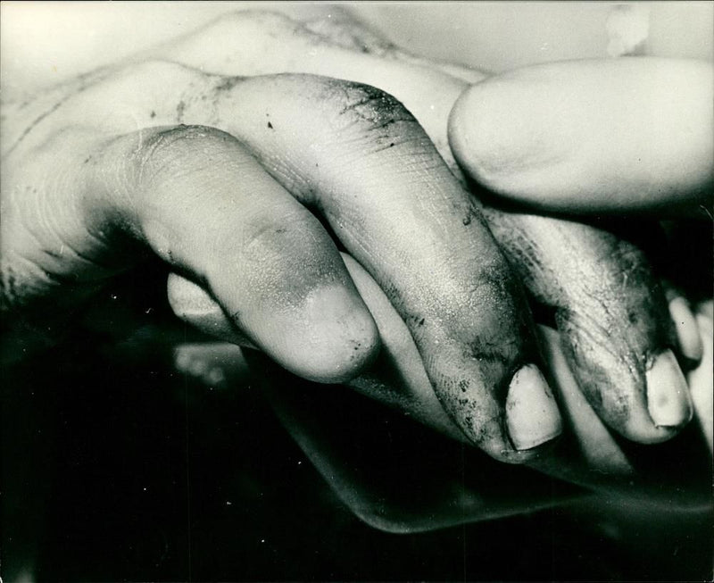Blood spattered hand of dead woman. - Vintage Photograph