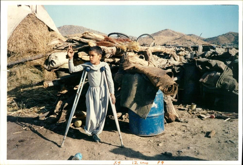 Twelve year old Hunner who lost the bottom half of his right leg. - Vintage Photograph