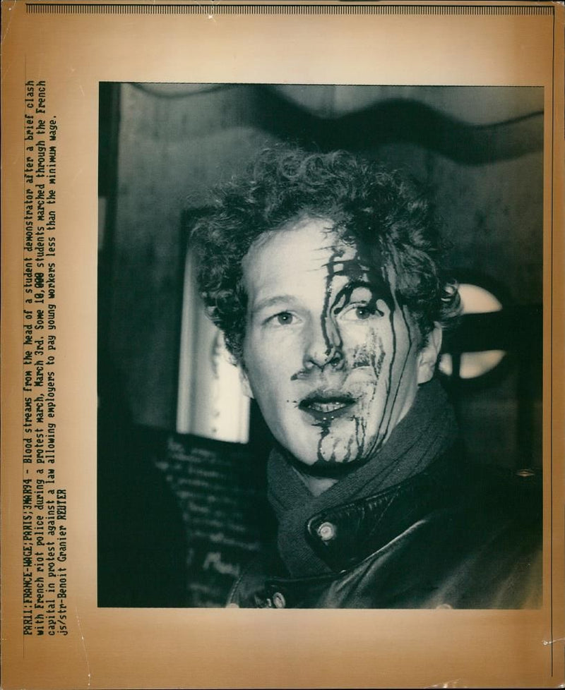 Blood Streams from the head of a students. - Vintage Photograph
