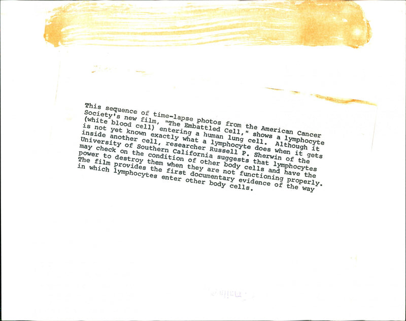 This sequence of time-lapse photos from the American Cancer Society's new film, "The Embattled Cell," shows a lymphocyte (white blood cell) entering a human lung cell. - Vintage Photograph