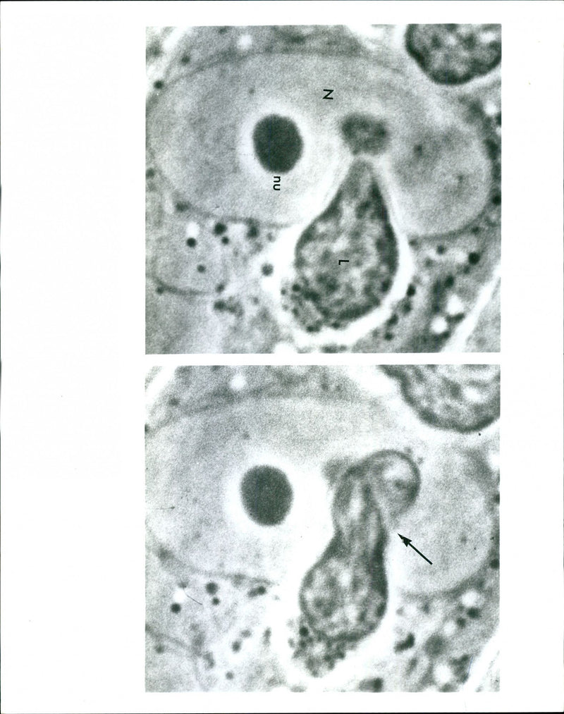 This sequence of time-lapse photos from the American Cancer Society's new film, "The Embattled Cell," shows a lymphocyte (white blood cell) entering a human lung cell. - Vintage Photograph