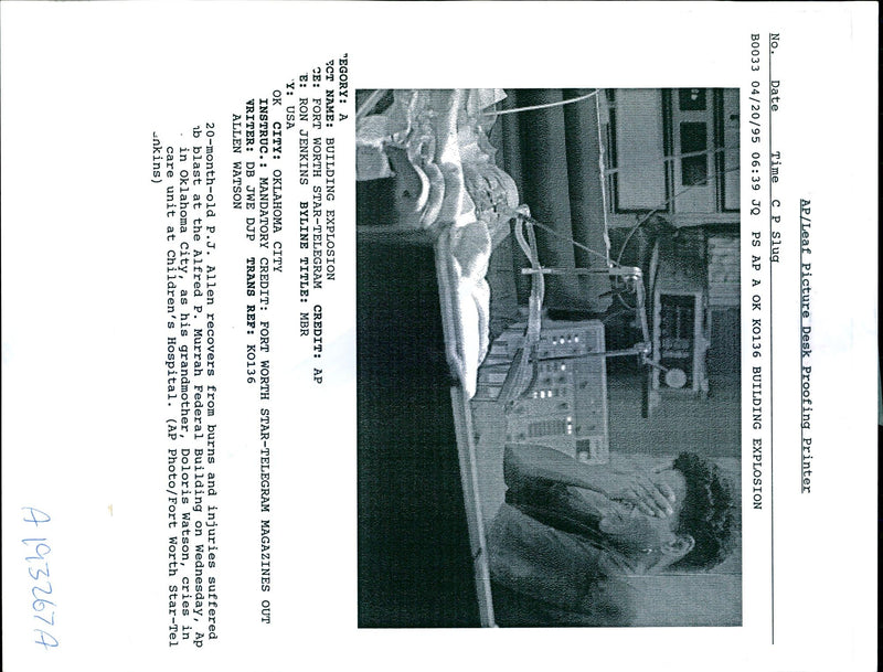 1995 MONTHOLD ALLEN RECOVERS FROM BURNS AND INJURIES SUFFERE STAR USA WRITER - Vintage Photograph