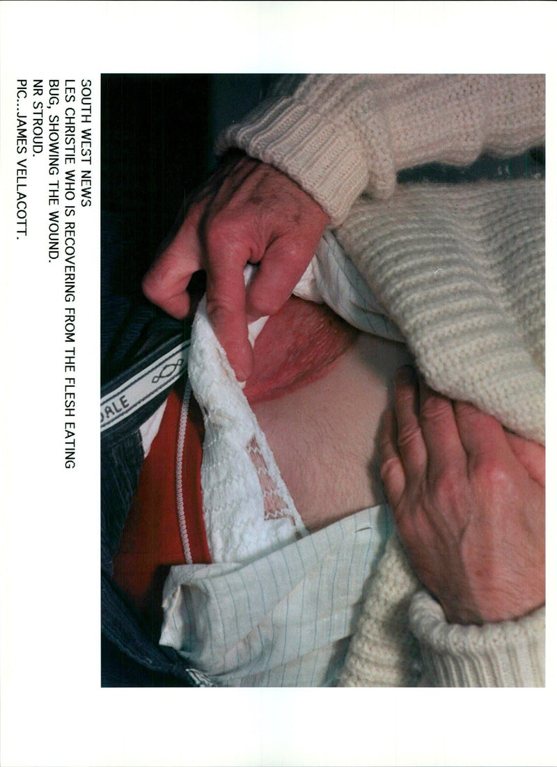 LES CHRISTIE RECOVERING FROM BITE AESH EATING JAMES VELLACOTT - Vintage Photograph