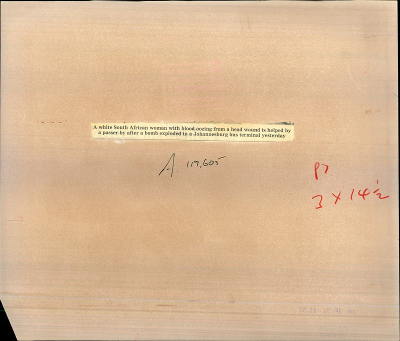 1968 WHITE SOUTH AFRICAN WOMAN WITH BLOOD OOZING FROM HEAD WOUND HELPED - Vintage Photograph