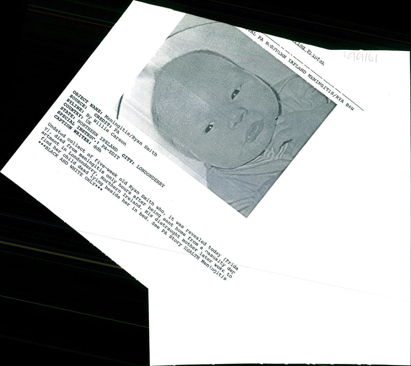 MENINGITIS WAS DEADLY DISEASE THAT BILL SMITH WHITE WRITER IRELAND BLACK - Vintage Photograph