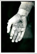Bloody Hand - Vintage Photograph