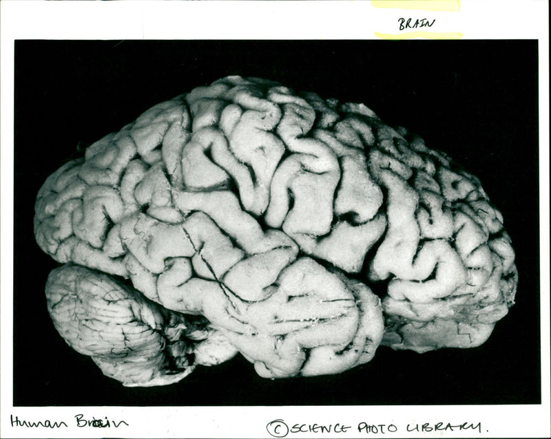 Brain - Vintage Photograph