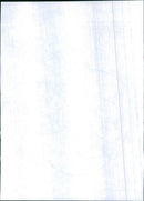 1981 Renault Alpine A310 V6 Brake system rear axle. - Vintage Photograph