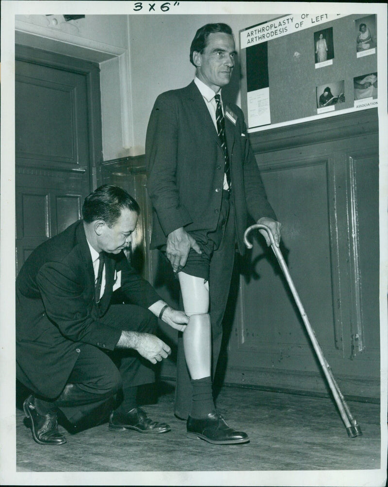 Sir James Lost Mentech proudly displays his legs in the hydraulically-controlled artificial leg during a demonstration at a conference on the rehabilitation of the disabled in Oxford, England. - Vintage Photograph